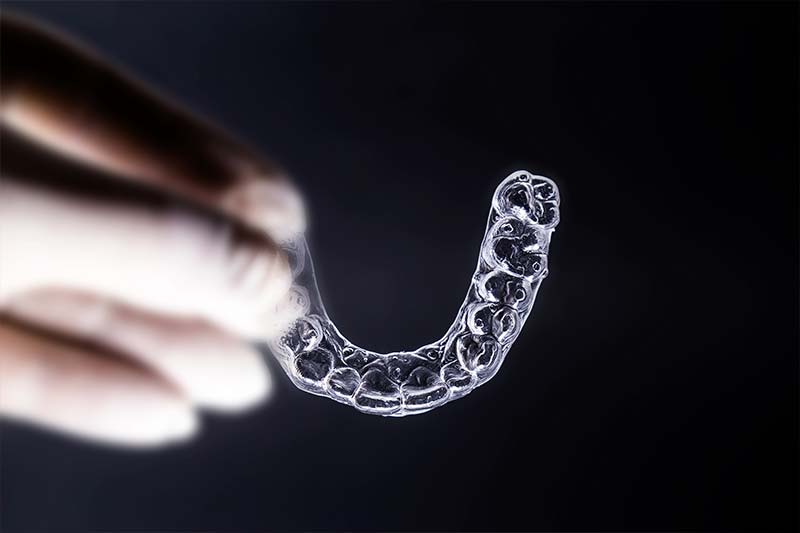 Alineadores a medida