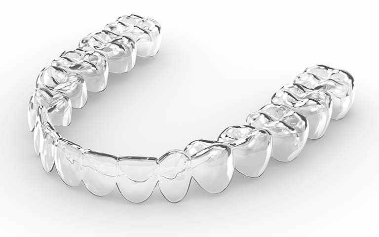 retenedores-ortodoncia-transparentes-removible